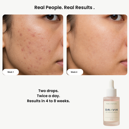 PDRN Barrier Essence
